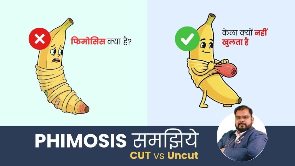 Phimosis Treatment in Delhi: Causes, Symptoms, and Advanced Solutions